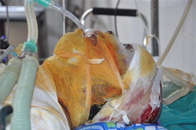 21 tuổi có lẽ em sẽ phải ra đi vì bố mẹ nghèo kiệt quệ rồi.