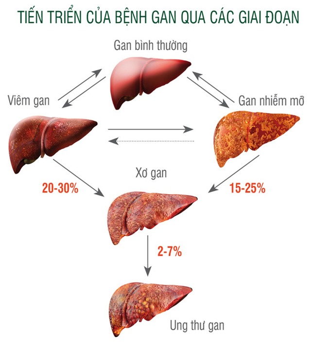 Bệnh nhân ung thư ân hận vì đã lơ là dấu hiệu chảy máu chân răng - Ảnh 2.