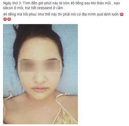 biến chứng sau thẩm mỹ