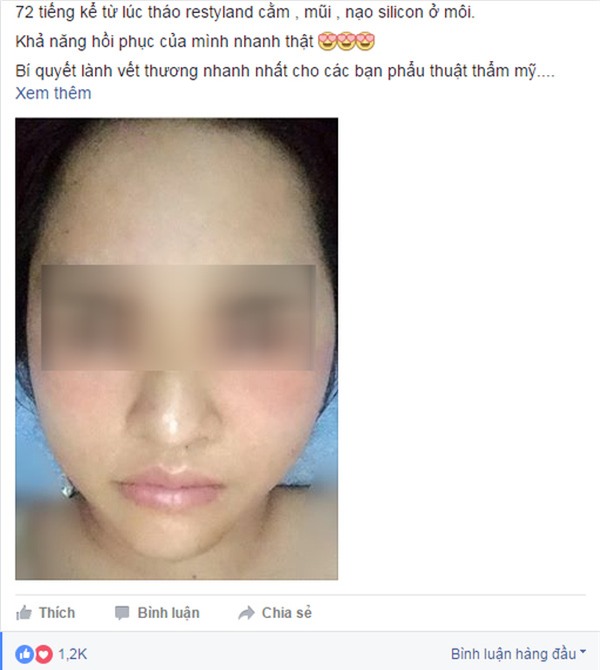 hậu quả sau thẩm mỹ