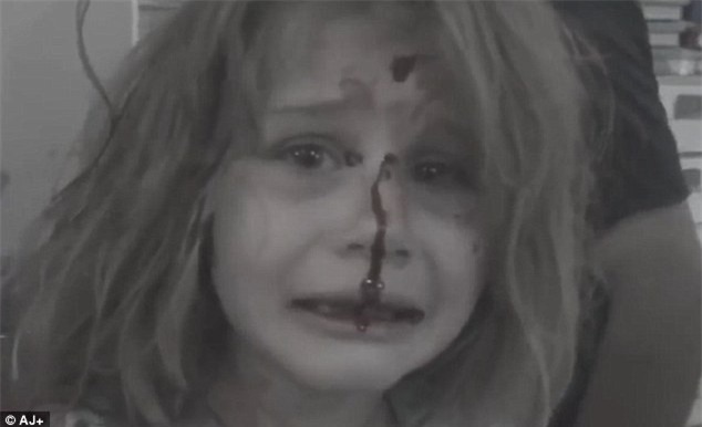 Bé gái Syria kêu khóc gọi cha với khuôn mặt đầy máu sau vụ nổ bom - Ảnh 2.