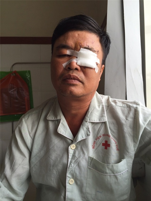 bi danh hong mat vi noi “em dua mic cho anh hat bai” hinh anh 2