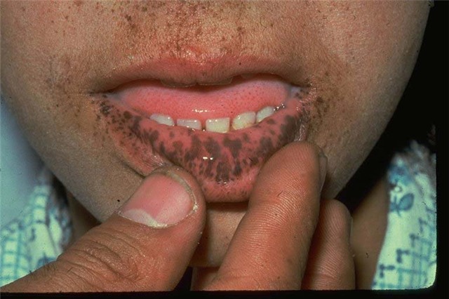 danh son ma khong biet den nhung dieu nay la ban dang 'tu sat' day - 4