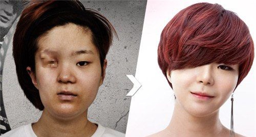 cap song sinh hot nhat tuan: man lot xac ngoan muc nho phau that tham my - 2