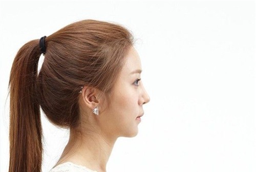 cap song sinh hot nhat tuan: man lot xac ngoan muc nho phau that tham my - 5