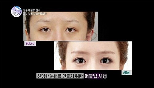 cap song sinh hot nhat tuan: man lot xac ngoan muc nho phau that tham my - 6