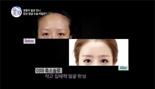 cap song sinh hot nhat tuan: man lot xac ngoan muc nho phau that tham my - 7