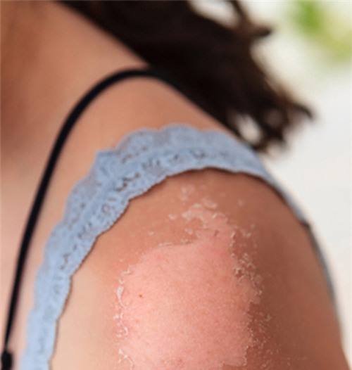 99% chi em se mua vitamin e ngay khi biet duoc nhung dieu nay - 8