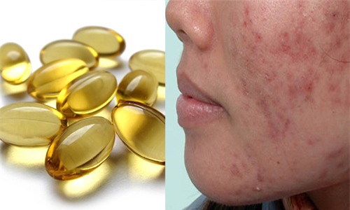 99% chi em se mua vitamin e ngay khi biet duoc nhung dieu nay - 3