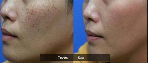 99% chi em se mua vitamin e ngay khi biet duoc nhung dieu nay - 5