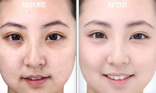 lay ruou trang pha voi nuoc che thoa len mat va xem dieu ki dieu gi xay ra - 4