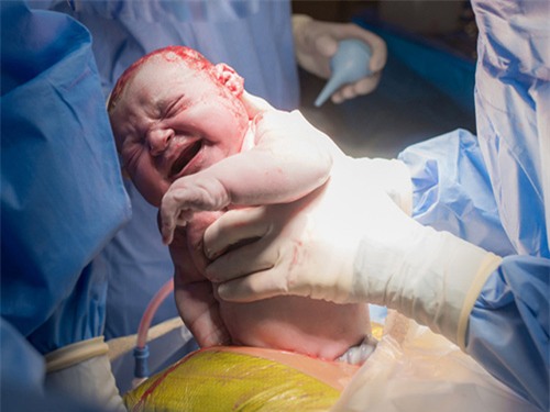 can ke cai chet sau ca sinh no, ba me “lanh nguoi” khi biet nguyen nhan - 2