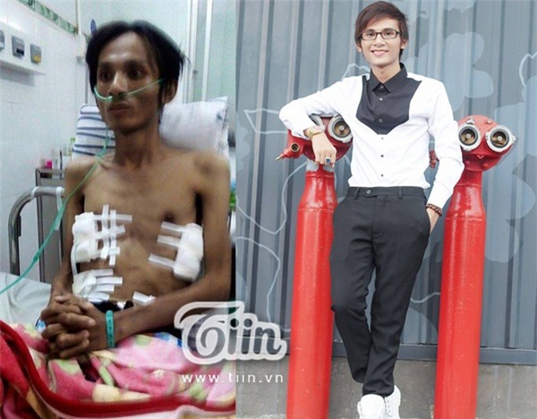 Thai-Lan-Vien-hoi-phuc-ki-dieu-sau-1-nam-benh-vien-tra-ve-blogtamsuvn0