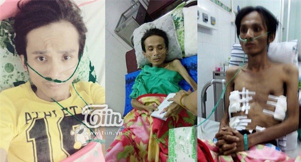 Thai-Lan-Vien-hoi-phuc-ki-dieu-sau-1-nam-benh-vien-tra-ve-blogtamsuvn02