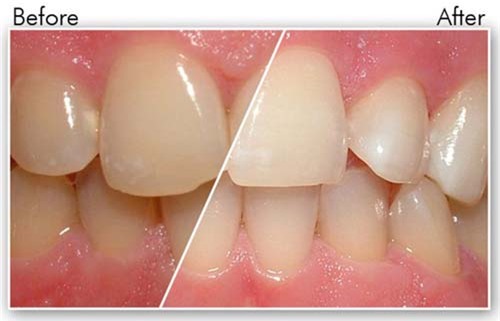 hau het chi em se ra cho mua ca can chanh khi biet nhung cong dung nay - 7