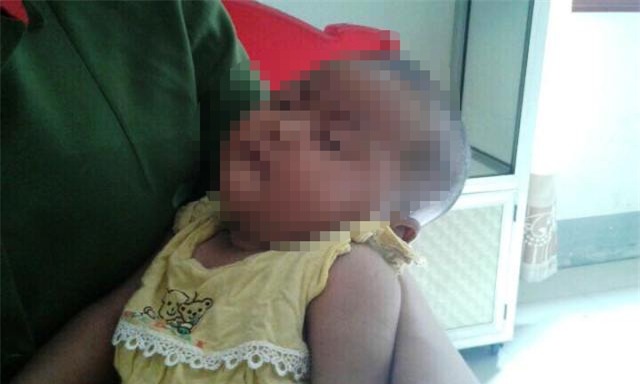 Bé 4 tháng tuổi bị