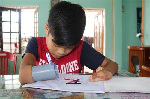 cau hoc tro cut 2 tay ve uoc mo doi minh bang… ong nhua - 3