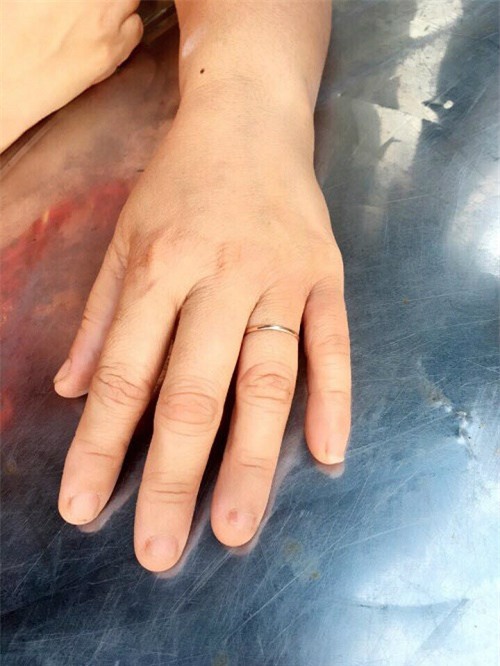 cuoc doi eo le cua nguoi phu nu mac ao co dau va ao tang chong cung mot ngay - 4