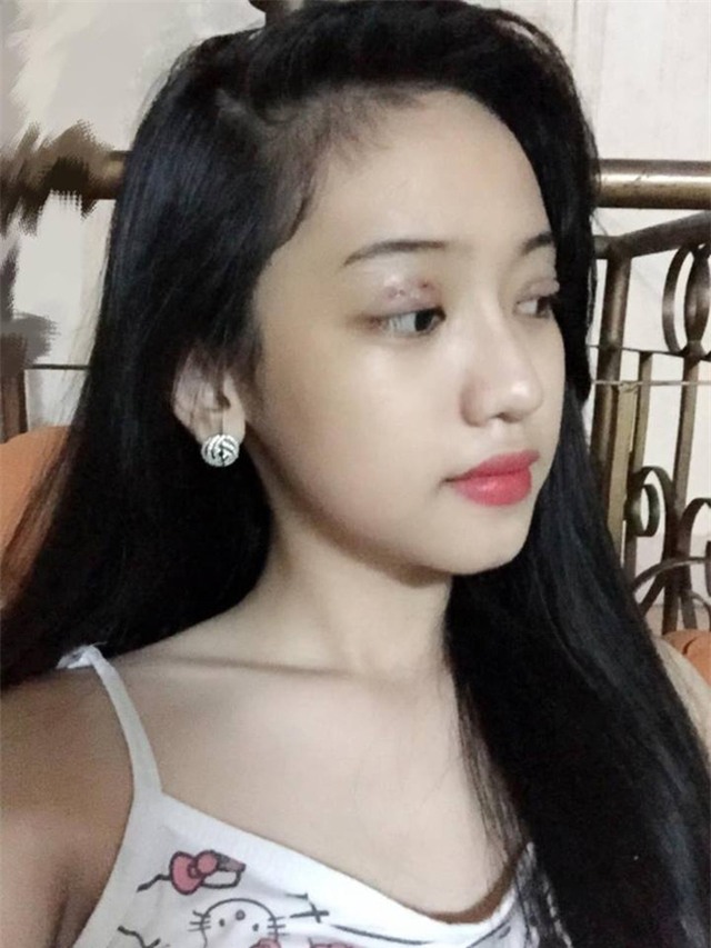 Thuý Vi tái xuất sau 1 tuần mất tích, với vòng 1 khủng và mí mắt sưng vù - Ảnh 7.