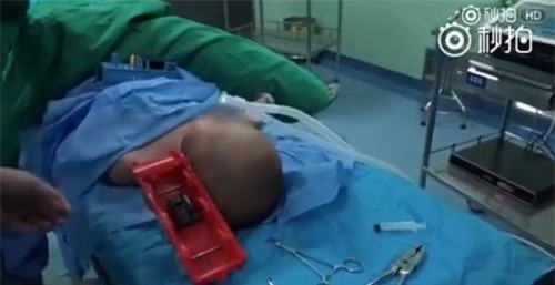 nga tu tren giuong xuong dat, be trai bi do choi gam vao dau - 1