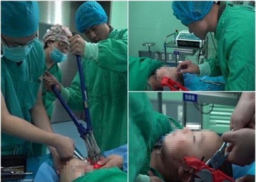 nga tu tren giuong xuong dat, be trai bi do choi gam vao dau - 2