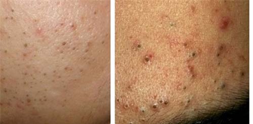 da bao gio ban thu dap mang boc thuc pham len mui chua? - 1