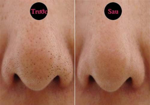 da bao gio ban thu dap mang boc thuc pham len mui chua? - 6