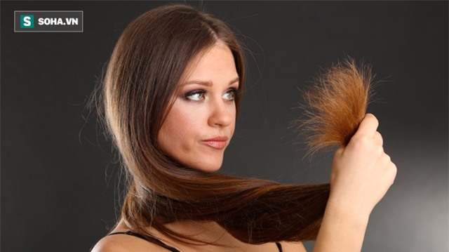 Nhìn tóc cũng có thể đoán ra cơ thể bạn đang mắc bệnh - Ảnh 3.