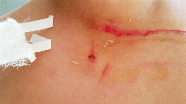 Phụ huynh tố thầy giáo hành hung học sinh đến chảy máu