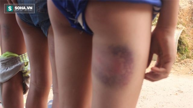 Thầy giáo đánh thâm tím đùi học sinh: Nhìn các em, tôi rất ân hận - Ảnh 1.