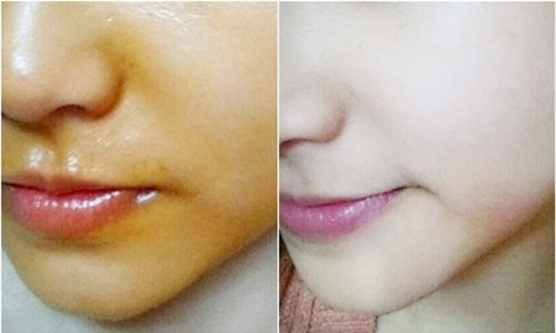 tinh-dau-gac-tri-nam-tan-nhang-duong-da-trang-blogtamsuvn5
