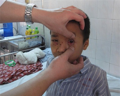 Hãy chú ý, ngoài bình gas, nhà bạn vẫn còn 2 quả bom nổ chậm này có thể gây cháy nhà bất kì lúc nào - Ảnh 3.