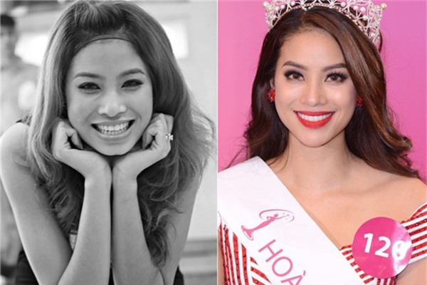 hoa hậu thẩm mỹ