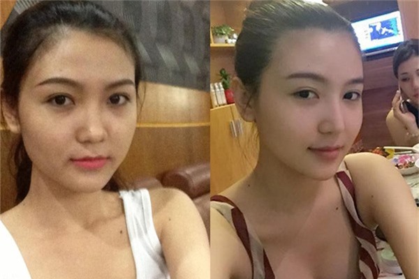 hoa hậu thẩm mỹ