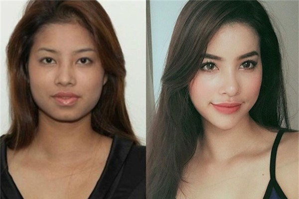 hoa hậu thẩm mỹ