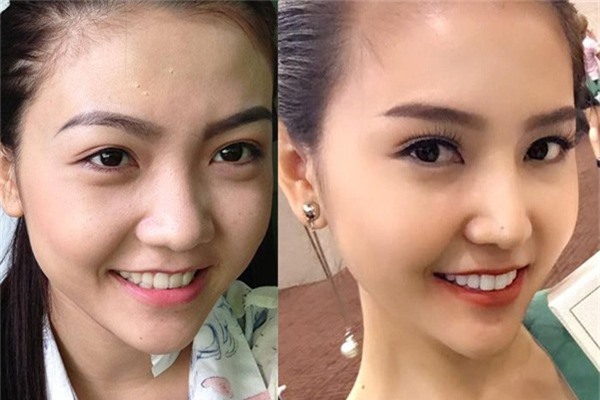 hoa hậu thẩm mỹ