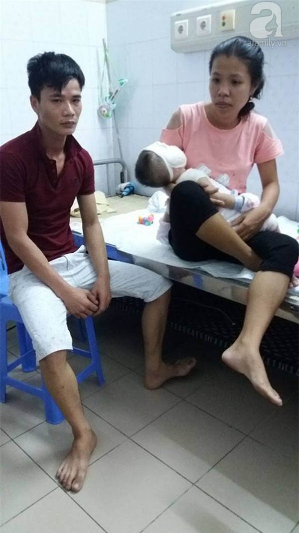 bé bị bỏng toàn thân