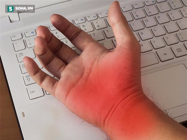 Cảnh báo bệnh nguy hiểm khi thường xuyên bị tê và ngứa ran ở tay - Ảnh 1.