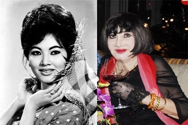 Thế nhưng, bà đã mắc phải sai lầm quá lớn khi lạm dụng phẫu thuật thẩm mỹ để níu kéo tuổi thanh xuân.