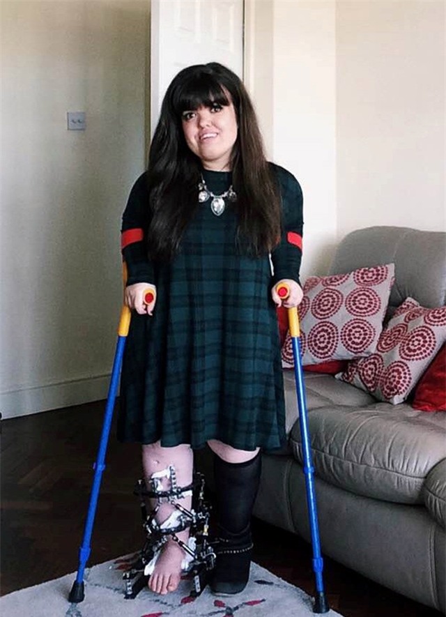 Bất chấp mọi đau đớn, cô gái kéo chân dài thêm 18cm - Ảnh 2.