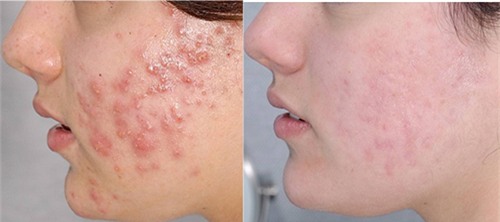 cha ca chua len mat 3 giay moi ngay va ket qua khien nhieu co gai bat ngo - 2