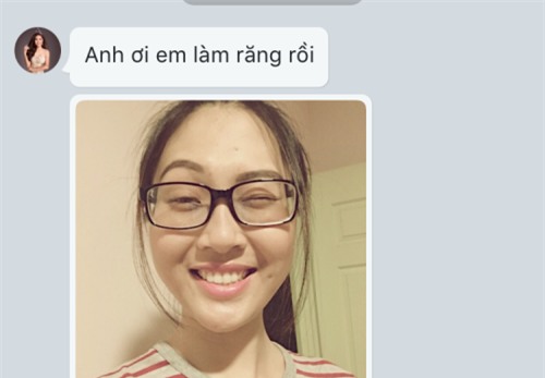 Dai dien Viet o Hoa hau The gioi bi to phau thuat tham my hinh anh 2