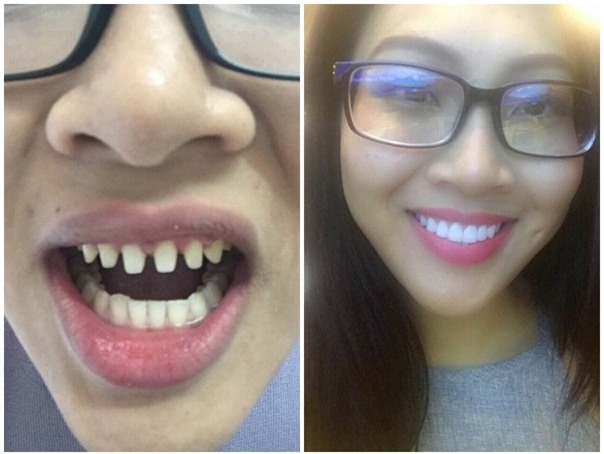 Dai dien Viet o Hoa hau The gioi bi to phau thuat tham my hinh anh 3