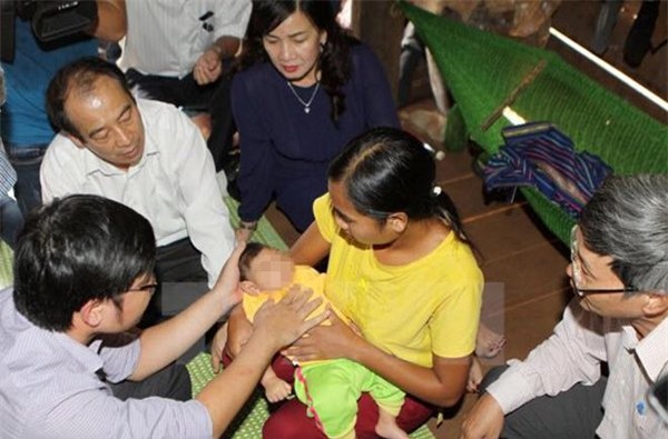 Zika, virus zika, triệu chứng mắc zika, dị tật đầu nhỏ