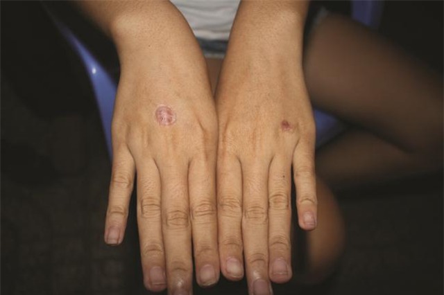 Tre bidanh, ha nhuc khong dam noi - Vi sao?