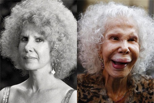 15 'thảm họa dao kéo' có khuôn mặt biến dạng đáng sợ - 1