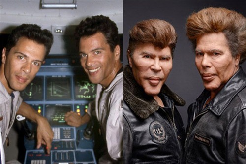 15 'thảm họa dao kéo' có khuôn mặt biến dạng đáng sợ - 6