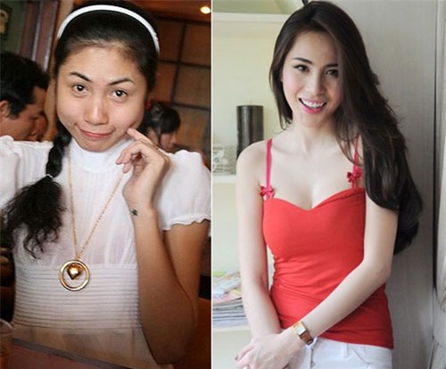Thủy Tiên phẫu thuật thẩm mỹ