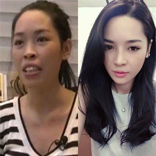 cuoc doi sang trang cua co gai lot xac nho phau thuat tham my - 13