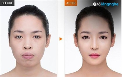 cuoc doi sang trang cua co gai lot xac nho phau thuat tham my - 2